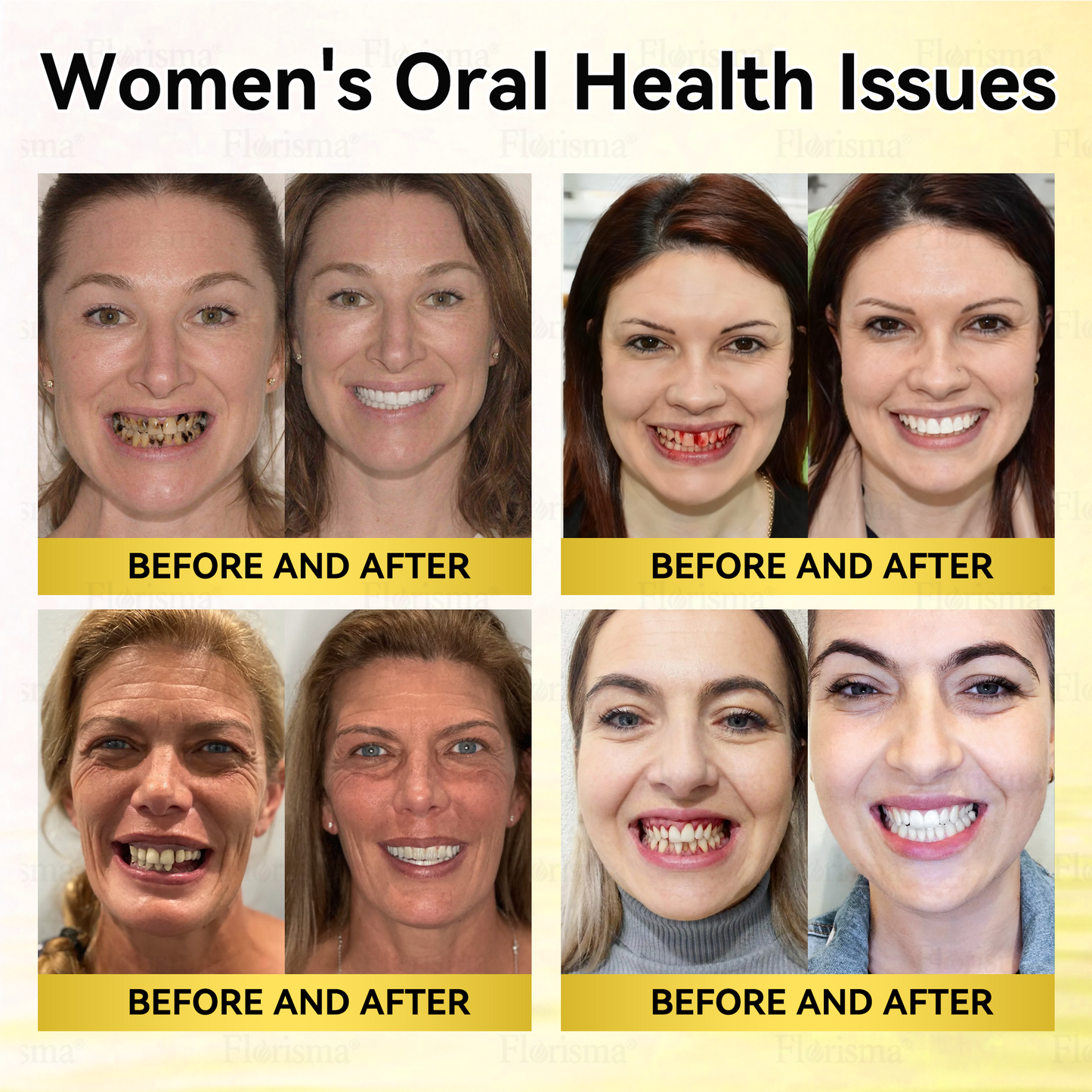 𝗢𝗳𝗳𝗶𝗰𝗶𝗮𝗹 𝗦𝘁𝗼𝗿𝗲 | ✨🦷 𝗙𝗹𝗼𝗿𝗶𝘀𝗺𝗮® 𝟯𝗩 𝗔𝗹𝗽𝗵𝗮-𝗛𝘆𝗱𝗿𝗼𝘅𝘆 𝗔𝗰𝗶𝗱 𝗧𝗲𝗲𝘁𝗵 𝗪𝗵𝗶𝘁𝗲𝗻𝗶𝗻𝗴 𝗘𝘀𝘀𝗲𝗻𝗰𝗲 🪥 ✔️ 𝗖𝗮𝘃𝗶𝘁𝘆 𝗥𝗲𝗽𝗮𝗶𝗿, 𝗚𝘂𝗺 𝗦𝘂𝗽𝗽𝗼𝗿𝘁, 𝗕𝗮𝗱 𝗕𝗿𝗲𝗮𝘁𝗵 𝗖𝗼𝗻𝘁𝗿𝗼𝗹, 𝗗𝗲𝗲𝗽 𝗪𝗵𝗶𝘁𝗲𝗻𝗶𝗻𝗴 ✨