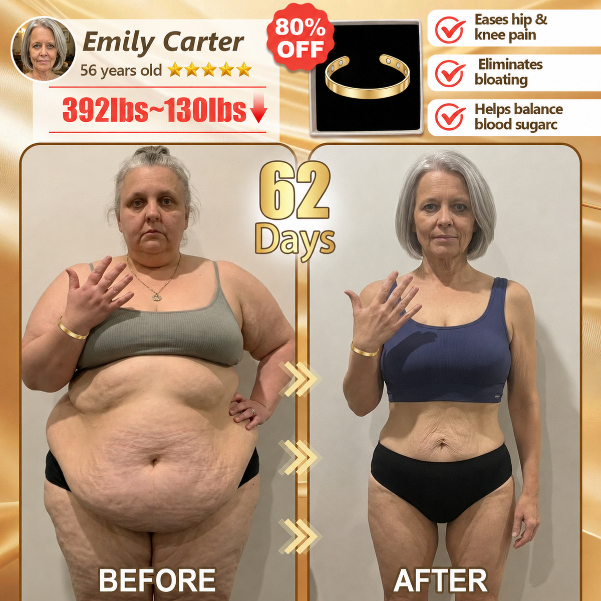 【2026 Weight Management】 ✅ 𝐂𝐙𝗧𝗜𝐶𝙇𝑬® 𝑀𝑒𝑡𝑎𝑏𝑜𝑙𝑖𝑠𝑚 𝑆𝑢𝑝𝑝𝑜𝑟𝑡 𝐵𝑟𝑎𝑐𝑒𝑙𝑒𝑡