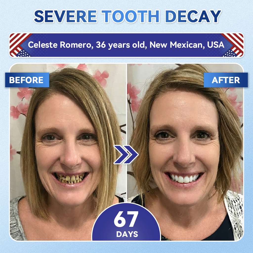 𝑮𝙄𝒊𝒎𝒎𝙚𝙧𝙄𝒚® 𝐓𝐢𝐝𝐞𝐠𝐥𝐮𝐬𝐢𝐛 𝐓𝐨𝐨𝐭𝐡 & 𝐆𝐮𝐦 𝐑𝐞𝐩𝐚𝐢𝐫 𝐅𝐚𝐬𝐭-𝐃𝐢𝐬𝐬𝐨𝐥𝐯𝐢𝐧𝐠 𝐖𝐡𝐢𝐭𝐞𝐧𝐢𝐧𝐠 𝐒𝐭𝐫𝐢𝐩𝐬  (𝟓-𝐢𝐧-𝟏🦷𝐑𝐞𝐛𝐮𝐢𝐥𝐝 𝐄𝐧𝐚𝐦𝐞𝐥 & 𝐃𝐞𝐧𝐭𝐢𝐧 • 𝐒𝐭𝐫𝐞𝐧𝐠𝐭𝐡𝐞𝐧 𝐆𝐮𝐦𝐬 • 𝐄𝐫𝐚𝐝𝐢𝐜𝐚𝐭𝐞 𝐓𝐚𝐫𝐭𝐚𝐫 & 𝐎𝐝𝐨𝐫 • 𝐖𝐡𝐢𝐭𝐞𝐧𝐢𝐧𝐠 • 𝐒𝐭𝐨𝐩 𝐓𝐨𝐨𝐭𝐡 𝐒𝐞𝐧𝐬𝐢𝐭𝐢𝐯𝐢𝐭𝐲) 🌿