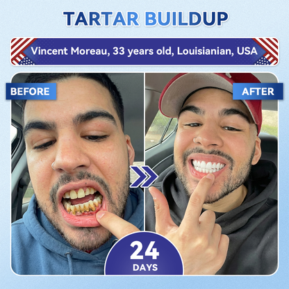 𝐆𝐥𝐢𝐦𝐦𝐞𝐫𝐥𝐲® 𝐓𝐢𝐝𝐞𝐠𝐥𝐮𝐬𝐢𝐛 𝐓𝐨𝐨𝐭𝐡 & 𝐆𝐮𝐦 𝐑𝐞𝐩𝐚𝐢𝐫 𝐌𝐢𝐜𝐫𝐨𝐧𝐞𝐞𝐝𝐥𝐞 𝐏𝐚𝐭𝐜𝐡 🦷 𝐀𝐝𝐯𝐚𝐧𝐜𝐞𝐝 𝐒𝐭𝐞𝐦-𝐂𝐞𝐥𝐥 𝐀𝐜𝐭𝐢𝐯𝐚𝐭𝐢𝐨𝐧 𝐓𝐞𝐞𝐭𝐡 𝐒𝐭𝐫𝐢𝐩𝐬 (𝐑𝐞𝐛𝐮𝐢𝐥𝐝 𝐄𝐧𝐚𝐦𝐞𝐥 & 𝐃𝐞𝐧𝐭𝐢𝐧 • 𝐒𝐭𝐫𝐞𝐧𝐠𝐭𝐡𝐞𝐧 𝐆𝐮𝐦𝐬 • 𝐄𝐫𝐚𝐝𝐢𝐜𝐚𝐭𝐞 𝐓𝐚𝐫𝐭𝐚𝐫 & 𝐎𝐝𝐨𝐫 • 𝐒𝐭𝐨𝐩 𝐓𝐨𝐨𝐭𝐡 𝐒𝐞𝐧𝐬𝐢𝐭𝐢𝐯𝐢𝐭𝐲)