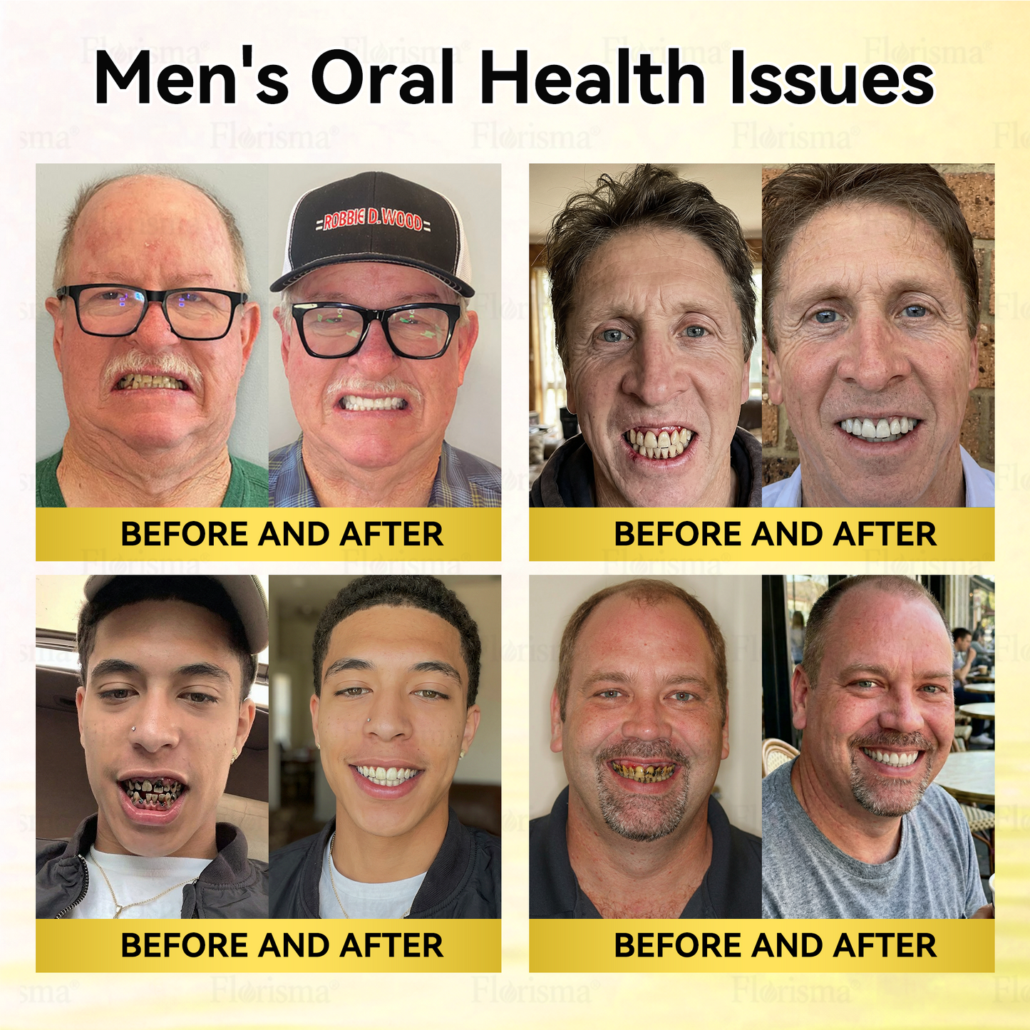 𝗢𝗳𝗳𝗶𝗰𝗶𝗮𝗹 𝗦𝘁𝗼𝗿𝗲 | ✨🦷 𝗙𝗹𝗼𝗿𝗶𝘀𝗺𝗮® 𝟯𝗩 𝗔𝗹𝗽𝗵𝗮-𝗛𝘆𝗱𝗿𝗼𝘅𝘆 𝗔𝗰𝗶𝗱 𝗧𝗲𝗲𝘁𝗵 𝗪𝗵𝗶𝘁𝗲𝗻𝗶𝗻𝗴 𝗘𝘀𝘀𝗲𝗻𝗰𝗲 🪥 ✔️ 𝗖𝗮𝘃𝗶𝘁𝘆 𝗥𝗲𝗽𝗮𝗶𝗿, 𝗚𝘂𝗺 𝗦𝘂𝗽𝗽𝗼𝗿𝘁, 𝗕𝗮𝗱 𝗕𝗿𝗲𝗮𝘁𝗵 𝗖𝗼𝗻𝘁𝗿𝗼𝗹, 𝗗𝗲𝗲𝗽 𝗪𝗵𝗶𝘁𝗲𝗻𝗶𝗻𝗴 ✨