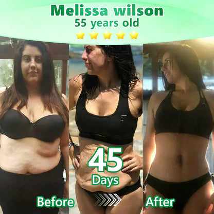 【𝗟𝗮𝘀𝘁 𝗗𝗮𝘆 𝗣𝗿𝗼𝗺𝗼𝘁𝗶𝗼𝗻 𝟴𝟬% 𝗢𝗙𝗙】𝗙𝗹𝗼𝗿𝗶𝘀𝗺𝗮® 𝗠𝗼𝗿𝗶𝗻𝗴𝗮 + 𝗕𝗲𝗿𝗯𝗲𝗿𝗶𝗻𝗲 + 𝗡𝗔𝗗+ 𝗦𝗹𝗶𝗺𝗺𝗶𝗻𝗴 & 𝗙𝗶𝗿𝗺𝗶𝗻𝗴 𝟮-𝗶𝗻-𝟭 𝗡𝗮𝗻𝗼 𝗠𝗶𝗰𝗿𝗼𝗻𝗲𝗲𝗱𝗹𝗲 𝗣𝗮𝘁𝗰𝗵 ✨ 𝟳 𝗣𝗮𝘁𝗰𝗵𝗲𝘀 𝗣𝗲𝗿 𝗕𝗼𝘅 · 𝗢𝗻𝗲-𝗪𝗲𝗲𝗸 𝗦𝘂𝗽𝗽𝗹𝘆 💪