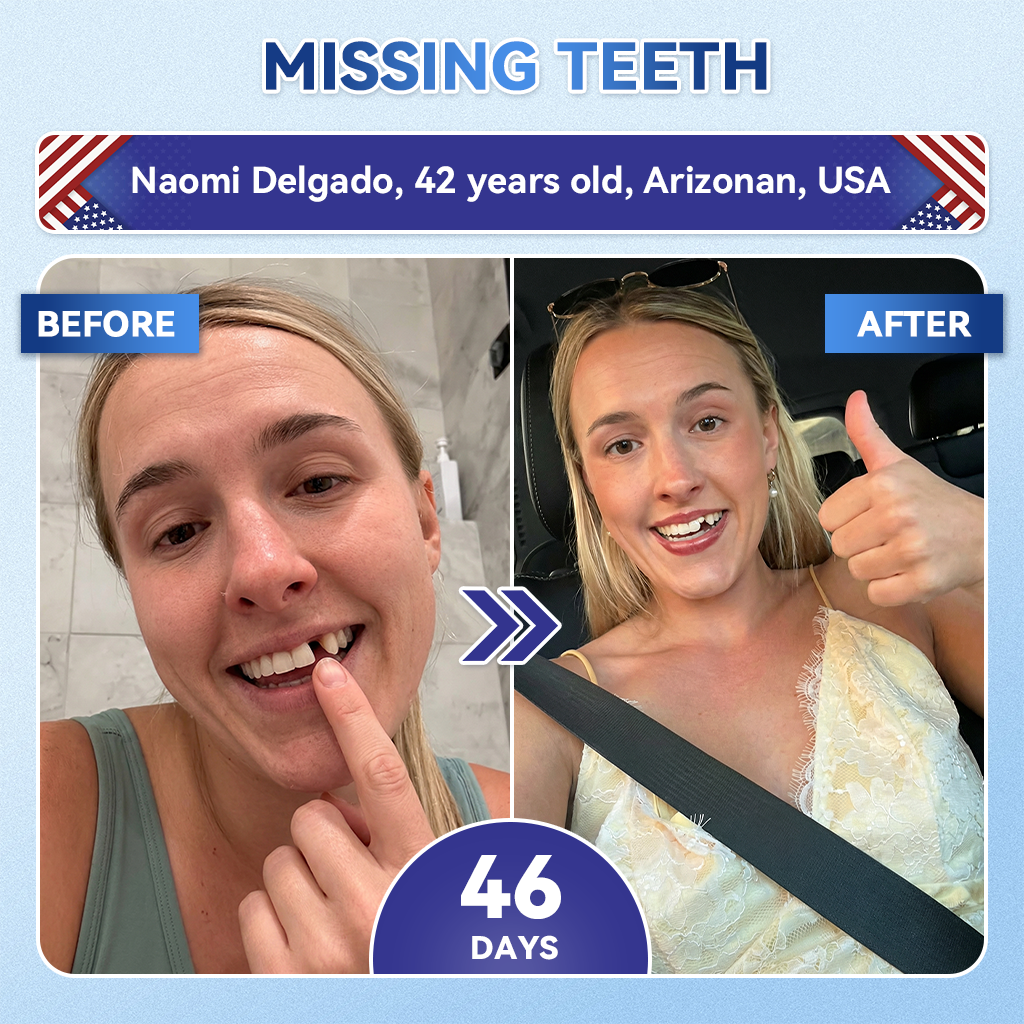 𝑮𝙄𝒊𝒎𝒎𝙚𝙧𝙄𝒚® 𝐓𝐢𝐝𝐞𝐠𝐥𝐮𝐬𝐢𝐛 𝐓𝐨𝐨𝐭𝐡 & 𝐆𝐮𝐦 𝐑𝐞𝐩𝐚𝐢𝐫 𝐅𝐚𝐬𝐭-𝐃𝐢𝐬𝐬𝐨𝐥𝐯𝐢𝐧𝐠 𝐖𝐡𝐢𝐭𝐞𝐧𝐢𝐧𝐠 𝐒𝐭𝐫𝐢𝐩𝐬  (𝟓-𝐢𝐧-𝟏🦷𝐑𝐞𝐛𝐮𝐢𝐥𝐝 𝐄𝐧𝐚𝐦𝐞𝐥 & 𝐃𝐞𝐧𝐭𝐢𝐧 • 𝐒𝐭𝐫𝐞𝐧𝐠𝐭𝐡𝐞𝐧 𝐆𝐮𝐦𝐬 • 𝐄𝐫𝐚𝐝𝐢𝐜𝐚𝐭𝐞 𝐓𝐚𝐫𝐭𝐚𝐫 & 𝐎𝐝𝐨𝐫 • 𝐖𝐡𝐢𝐭𝐞𝐧𝐢𝐧𝐠 • 𝐒𝐭𝐨𝐩 𝐓𝐨𝐨𝐭𝐡 𝐒𝐞𝐧𝐬𝐢𝐭𝐢𝐯𝐢𝐭𝐲) 🌿