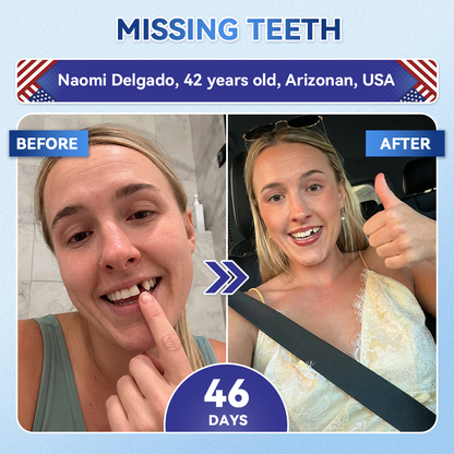 𝑮𝙄𝒊𝒎𝒎𝙚𝙧𝙄𝒚® 𝐓𝐢𝐝𝐞𝐠𝐥𝐮𝐬𝐢𝐛 𝐓𝐨𝐨𝐭𝐡 & 𝐆𝐮𝐦 𝐑𝐞𝐩𝐚𝐢𝐫 𝐅𝐚𝐬𝐭-𝐃𝐢𝐬𝐬𝐨𝐥𝐯𝐢𝐧𝐠 𝐖𝐡𝐢𝐭𝐞𝐧𝐢𝐧𝐠 𝐒𝐭𝐫𝐢𝐩𝐬  (𝟓-𝐢𝐧-𝟏🦷𝐑𝐞𝐛𝐮𝐢𝐥𝐝 𝐄𝐧𝐚𝐦𝐞𝐥 & 𝐃𝐞𝐧𝐭𝐢𝐧 • 𝐒𝐭𝐫𝐞𝐧𝐠𝐭𝐡𝐞𝐧 𝐆𝐮𝐦𝐬 • 𝐄𝐫𝐚𝐝𝐢𝐜𝐚𝐭𝐞 𝐓𝐚𝐫𝐭𝐚𝐫 & 𝐎𝐝𝐨𝐫 • 𝐖𝐡𝐢𝐭𝐞𝐧𝐢𝐧𝐠 • 𝐒𝐭𝐨𝐩 𝐓𝐨𝐨𝐭𝐡 𝐒𝐞𝐧𝐬𝐢𝐭𝐢𝐯𝐢𝐭𝐲) 🌿
