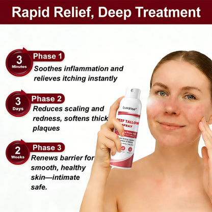 𝗟𝘂𝘅𝗮𝗿𝗶𝘀𝒆® 𝗕𝗲𝗲𝗳 𝗧𝗮𝗹𝗹𝗼𝘄 𝗦𝗽𝗿𝗮𝘆 𝗳𝗼𝗿 𝗜𝘁𝗰𝗵𝘆, 𝗙𝗹𝗮𝗸𝘆 𝗣𝘀𝗼𝗿𝗶𝗮𝘀𝗶𝘀 𝗦𝗸𝗶𝗻 💧