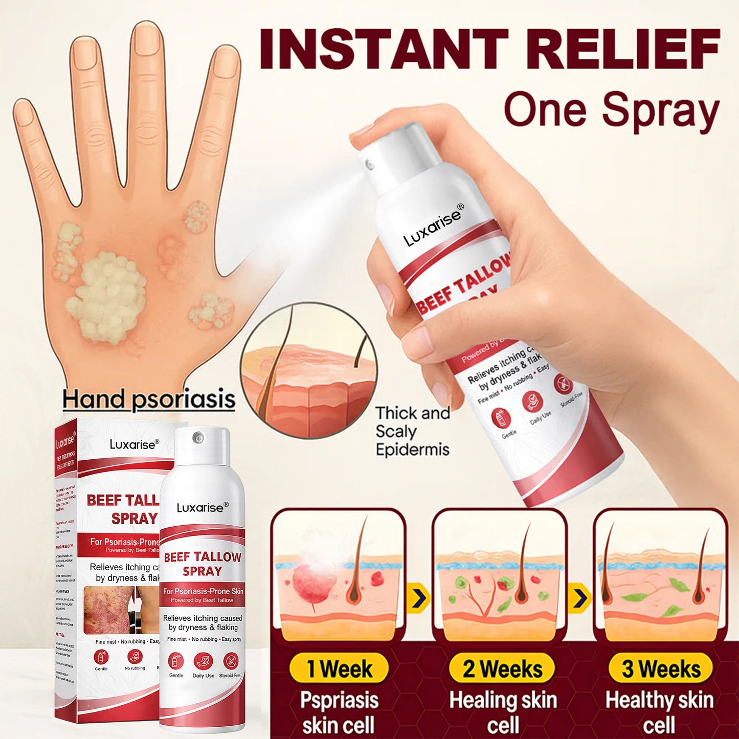 𝗟𝘂𝘅𝗮𝗿𝗶𝘀𝒆® 𝗕𝗲𝗲𝗳 𝗧𝗮𝗹𝗹𝗼𝘄 𝗦𝗽𝗿𝗮𝘆 𝗳𝗼𝗿 𝗜𝘁𝗰𝗵𝘆, 𝗙𝗹𝗮𝗸𝘆 𝗣𝘀𝗼𝗿𝗶𝗮𝘀𝗶𝘀 𝗦𝗸𝗶𝗻 💧