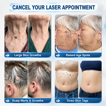 𝗣𝗂𝖼𝑑𝑜® 𝟳-𝗗𝗮𝘆 𝗧𝖺𝗀 & 𝗦𝗉𝗈𝗍 𝗘𝗋𝖺𝗌𝖾𝗋 𝗥𝗈𝗅𝗅𝖾𝗋𝖻𝖺𝗅𝗅 ⚡