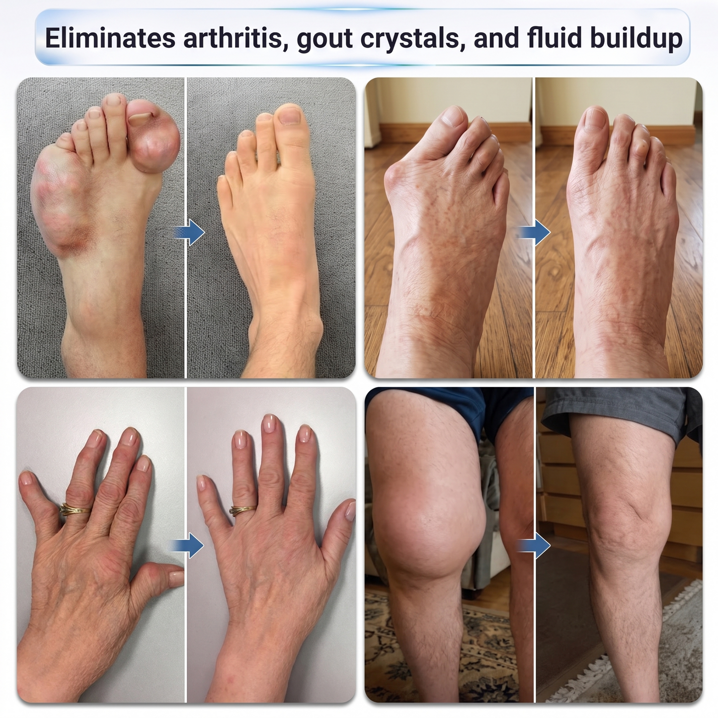 𝗜𝐅𝙈𝗔𝑮𝗜𝐂® 🦴 𝟬.𝟬𝟱𝗺𝗺 𝐌𝐢𝐜𝐫𝗼𝗻𝗲𝗲𝙙𝙡𝙚 𝑩𝒐𝒏𝒆 & 𝐉𝐨𝗶𝗻𝘁 𝗥𝗼𝗹𝗹𝒆𝙧🌿