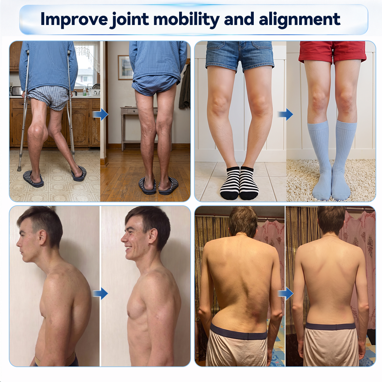 𝗜𝐅𝙈𝗔𝑮𝗜𝐂® 🦴 𝟬.𝟬𝟱𝗺𝗺 𝐌𝐢𝐜𝐫𝗼𝗻𝗲𝗲𝙙𝙡𝙚 𝑩𝒐𝒏𝒆 & 𝐉𝐨𝗶𝗻𝘁 𝗥𝗼𝗹𝗹𝒆𝙧🌿