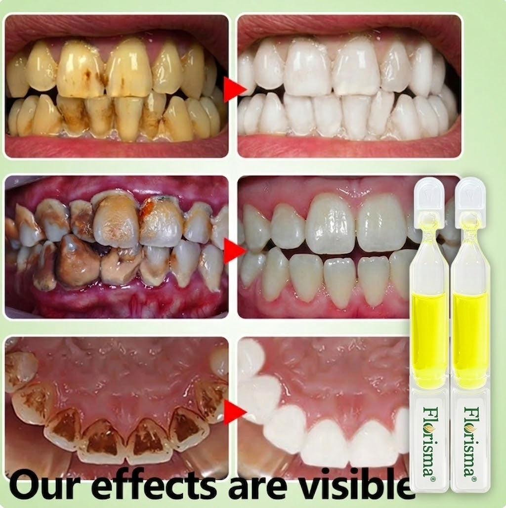 𝗙𝗹𝗼𝗿𝗶𝘀𝗺𝗮® 𝗧𝗥𝗚 𝗘𝗻𝗮𝗺𝗲𝗹 𝗥𝗲𝗽𝗮𝗶𝗿 𝗔𝗺𝗽𝗼𝘂𝗹𝗲 𝗧𝗼𝗼𝘁𝗵𝗽𝗮𝘀𝘁𝗲