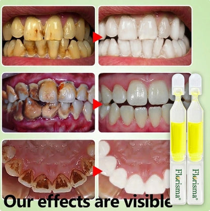 𝗙𝗹𝗼𝗿𝗶𝘀𝗺𝗮® 𝗧𝗥𝗚 𝗘𝗻𝗮𝗺𝗲𝗹 𝗥𝗲𝗽𝗮𝗶𝗿 𝗔𝗺𝗽𝗼𝘂𝗹𝗲 𝗧𝗼𝗼𝘁𝗵𝗽𝗮𝘀𝘁𝗲
