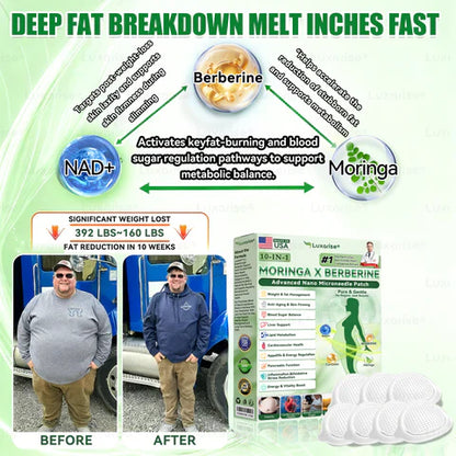 𝗟𝘂𝘅𝗮𝗿𝗶𝘀𝗲® 𝗢𝗳𝗳𝗶𝗰𝗶𝗮𝗹 𝗦𝘁𝗼𝗿𝗲 | 𝗠𝗼𝗿𝗶𝗻𝗴𝗮 & 𝗕𝗲𝗿𝗯𝗲𝗿𝗶𝗻𝗲 𝟭𝟬-𝗜𝗡-𝟭 𝗔𝗱𝘃𝗮𝗻𝗰𝗲𝗱 𝗡𝗮𝗻𝗼 𝗠𝗶𝗰𝗿𝗼𝗻𝗲𝗲𝗱𝗹𝗲 𝗣𝗮𝘁𝗰𝗵 (𝗢𝗻𝗰𝗲 𝗮 𝗗𝗮𝘆 - 𝗩𝗶𝘀𝗶𝗯𝗹𝗲 𝗥𝗲𝘀𝘂𝗹𝘁𝘀 𝗶𝗻 𝗝𝘂𝘀𝘁 𝟳 𝗗𝗮𝘆𝘀)